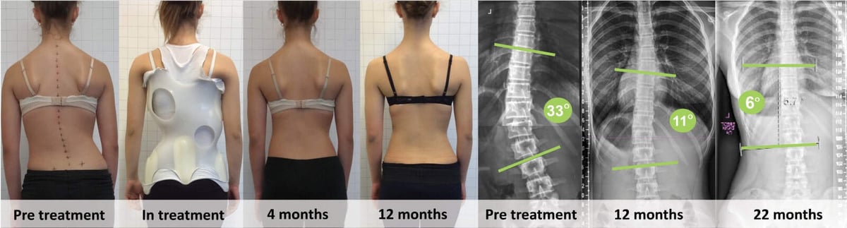spinecare-chiropractic-landing-picture_orig