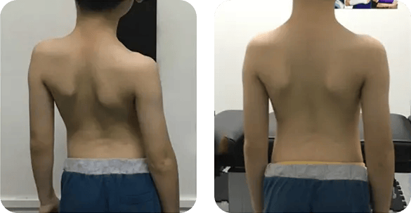 before-after-img-1