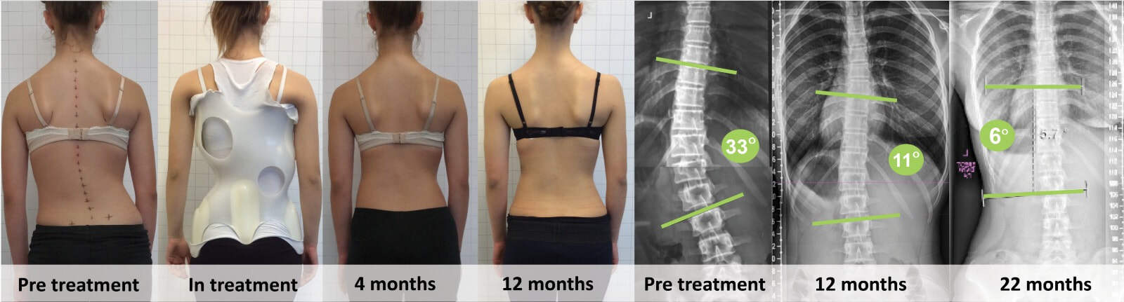 spinecare-chiropractic-landing-picture_orig