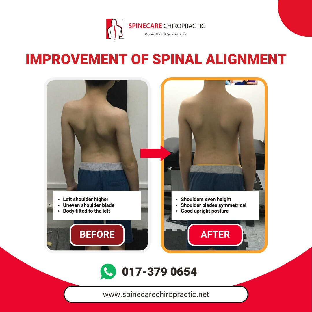 spinecare-chiropractic-supporting-images-3_orig (1)