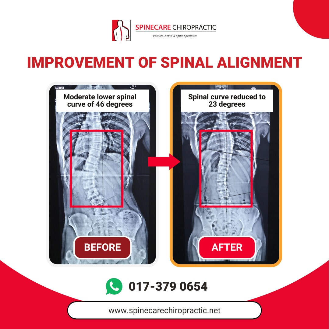 spinecare-chiropractic-supporting-images-4_orig