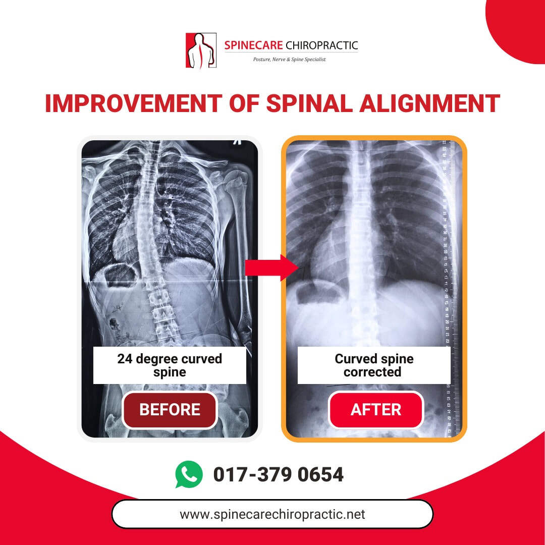spinecare-chiropractic-supporting-images-5_orig