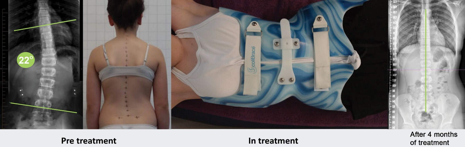 spinecare-chiropractic-treatment-picture-1_orig