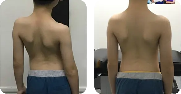 before-after-img-1 before-after-img-1